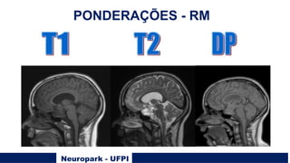 Neuropark - UFPI
PONDERAÇÕES - RM
 
