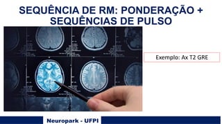 Neuropark - UFPI
SEQUÊNCIA DE RM: PONDERAÇÃO +
SEQUÊNCIAS DE PULSO
Exemplo: Ax T2 GRE
 