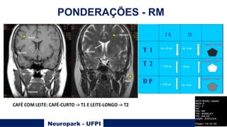 Neuropark - UFPI
PONDERAÇÕES - RM
 
