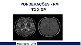 Neuropark - UFPI
PONDERAÇÕES - RM
 