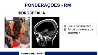 Neuropark - UFPI
PONDERAÇÕES - RM
1) Qual a ponderação?
2) Foi utilizado meios de
contraste?
 