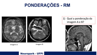 Neuropark - UFPI
PONDERAÇÕES - RM
1) Qual a ponderação da
imagem A e B?
Imagem A Imagem B
 