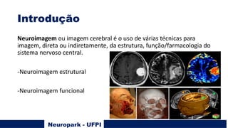 Introdução
Neuroimagem ou imagem cerebral é o uso de várias técnicas para
imagem, direta ou indiretamente, da estrutura, função/farmacologia do
sistema nervoso central.
-Neuroimagem estrutural
-Neuroimagem funcional
Neuropark - UFPI
 