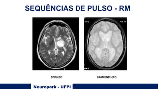 Neuropark - UFPI
SEQUÊNCIAS DE PULSO - RM
 