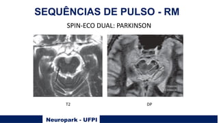 Neuropark - UFPI
SEQUÊNCIAS DE PULSO - RM
SPIN-ECO DUAL: PARKINSON
T2 DP
 