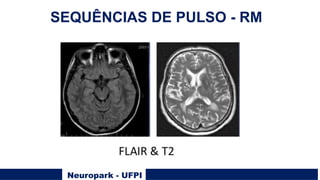 Neuropark - UFPI
SEQUÊNCIAS DE PULSO - RM
 