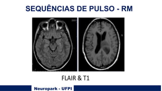 Neuropark - UFPI
SEQUÊNCIAS DE PULSO - RM
 