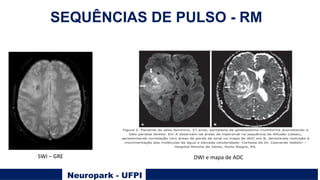Neuropark - UFPI
SEQUÊNCIAS DE PULSO - RM
SWI – GRE DWI e mapa de ADC
 