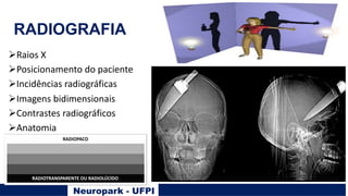 Neuropark - UFPI
RADIOGRAFIA
ØRaios X
ØPosicionamento do paciente
ØIncidências radiográficas
ØImagens bidimensionais
ØContrastes radiográficos
ØAnatomia
RADIOPACO
RADIOTRANSPARENTE OU RADIOLÚCIDO
 