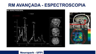 Neuropark - UFPI
RM AVANÇADA - ESPECTROSCOPIA
 
