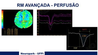 Neuropark - UFPI
RM AVANÇADA - PERFUSÃO
 