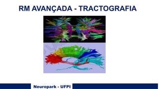 Neuropark - UFPI
RM AVANÇADA - TRACTOGRAFIA
 