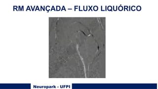 Neuropark - UFPI
RM AVANÇADA – FLUXO LIQUÓRICO
 