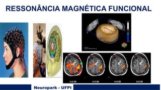 Neuropark - UFPI
RESSONÂNCIA MAGNÉTICA FUNCIONAL
 