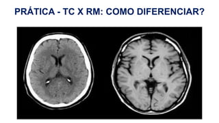 PRÁTICA - TC X RM: COMO DIFERENCIAR?
H
 