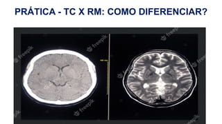 H
PRÁTICA - TC X RM: COMO DIFERENCIAR?
 