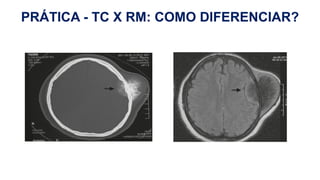 H
PRÁTICA - TC X RM: COMO DIFERENCIAR?
 