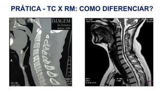 H
PRÁTICA - TC X RM: COMO DIFERENCIAR?
 