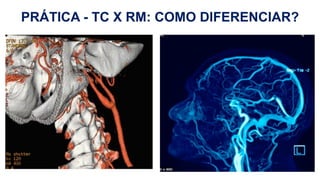 H
PRÁTICA - TC X RM: COMO DIFERENCIAR?
 