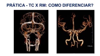 H
PRÁTICA - TC X RM: COMO DIFERENCIAR?
 