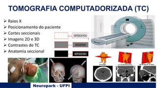 Neuropark - UFPI
Ø Raios X
Ø Posicionamento do paciente
Ø Cortes seccionais
Ø Imagens 2D e 3D
Ø Contrastes de TC
Ø Anatomia seccional
TOMOGRAFIA COMPUTADORIZADA (TC)
 