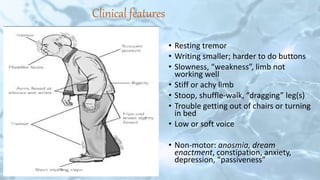 Clinical features
• Resting tremor
• Writing smaller; harder to do buttons
• Slowness, “weakness”, limb not
working well
• Stiff or achy limb
• Stoop, shuffle-walk, “dragging” leg(s)
• Trouble getting out of chairs or turning
in bed
• Low or soft voice
• Non-motor: anosmia, dream
enactment, constipation, anxiety,
depression, “passiveness”
 