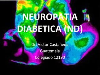 NEUROPATIA DIABETICA (ND) Dr. Víctor Castañeda Guatemala Colegiado 12190 