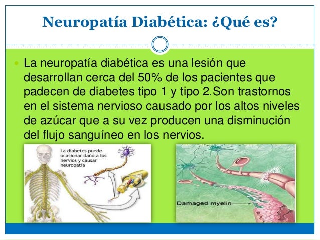 Chong, Stephany: Neuropatía Diabética Chong, Stephany: Neuropatía Diabética