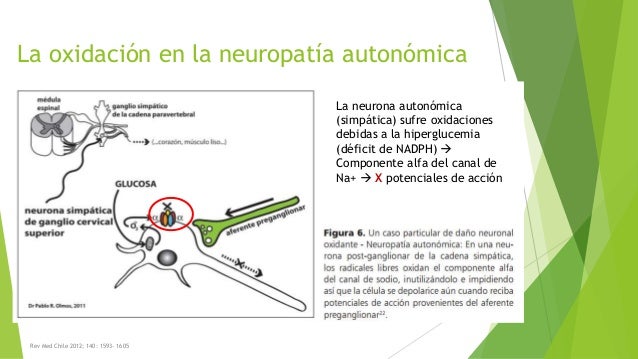 Neuropatía diabética Neuropatía diabética