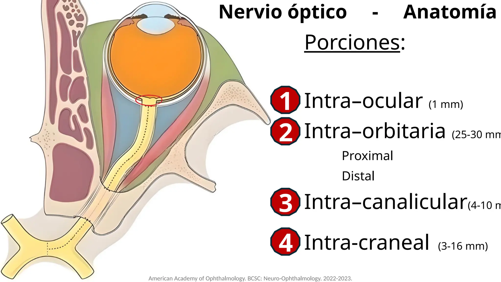 Neuropatía óptica traumática (Nervio óptico, defecto pupilar aferente ...