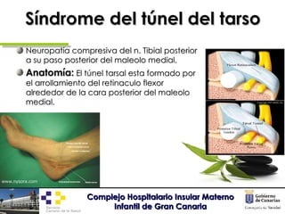 Síndrome del túnel del tarso <ul><li>Neuropatía compresiva del n. Tibial posterior a su paso posterior del maleolo medial....