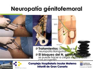 Neuropatía génitofemoral <ul><li>Tratamientos:  Similares a la neuropatía ilioinguinal. </li></ul><ul><li>El bloqueo del N...