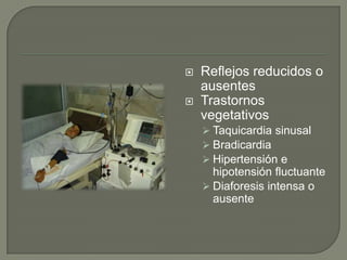    Reflejos reducidos o
    ausentes
   Trastornos
    vegetativos
     Taquicardia sinusal
     Bradicardia
     Hipertensión e
      hipotensión fluctuante
     Diaforesis intensa o
      ausente
 