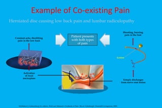 Example of Co-existing Pain Patient presents with both types of pain Herniated disc causing low back pain and lumbar radiculopathy McMahon S, Koltzenburg M, editors. Wall and Melzack's Textbook of Pain. 5th ed. Edinburgh: Churchill-Livingstone; 2005. Constant ache, throbbing pain in the low back Lesion Shooting, burning pain in the foot Activation of local nociceptors Ectopic discharges from nerve root lesion 
