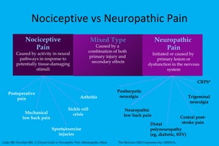Nociceptive vs Neuropathic Pain Mixed   Type Caused by a  combination of both  primary injury and  secondary effects Nociceptive Pain Caused by activity in neural pathways in response to potentially tissue-damaging stimuli Neuropathic  Pain Initiated or caused by  primary lesion or dysfunction in the nervous system Postoperative pain Mechanical low back pain Sickle cell crisis Arthritis Postherpetic neuralgia  Neuropathic  low back pain CRPS* Sports/exercise injuries Central post- stroke pain Trigeminal neuralgia Distal polyneuropathy  (eg, diabetic, HIV) . Galer BS, Dworkin RH.  A Clinical Guide to Neuropathic Pain . Minneapolis, Minn:  The McGraw-Hill Companies Inc; 2000:8-9 . 