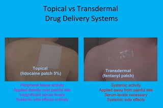 Topical vs Transdermal  Drug Delivery Systems Systemic activity Applied away from painful site Serum levels necessary Systemic side effects Peripheral tissue activity Applied directly over painful site Insignificant serum levels Systemic side effects unlikely Topical  (lidocaine patch 5%) Transdermal (fentanyl patch) 