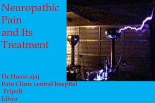 Neuropathic Pain and Its Treatment 