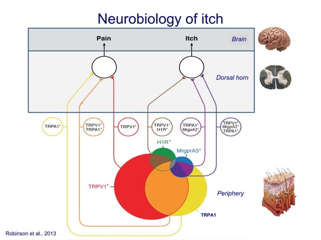 Nerve Damage Rash Neuropathic Itch: Routes To Clinical Diagnosis – IRYZ