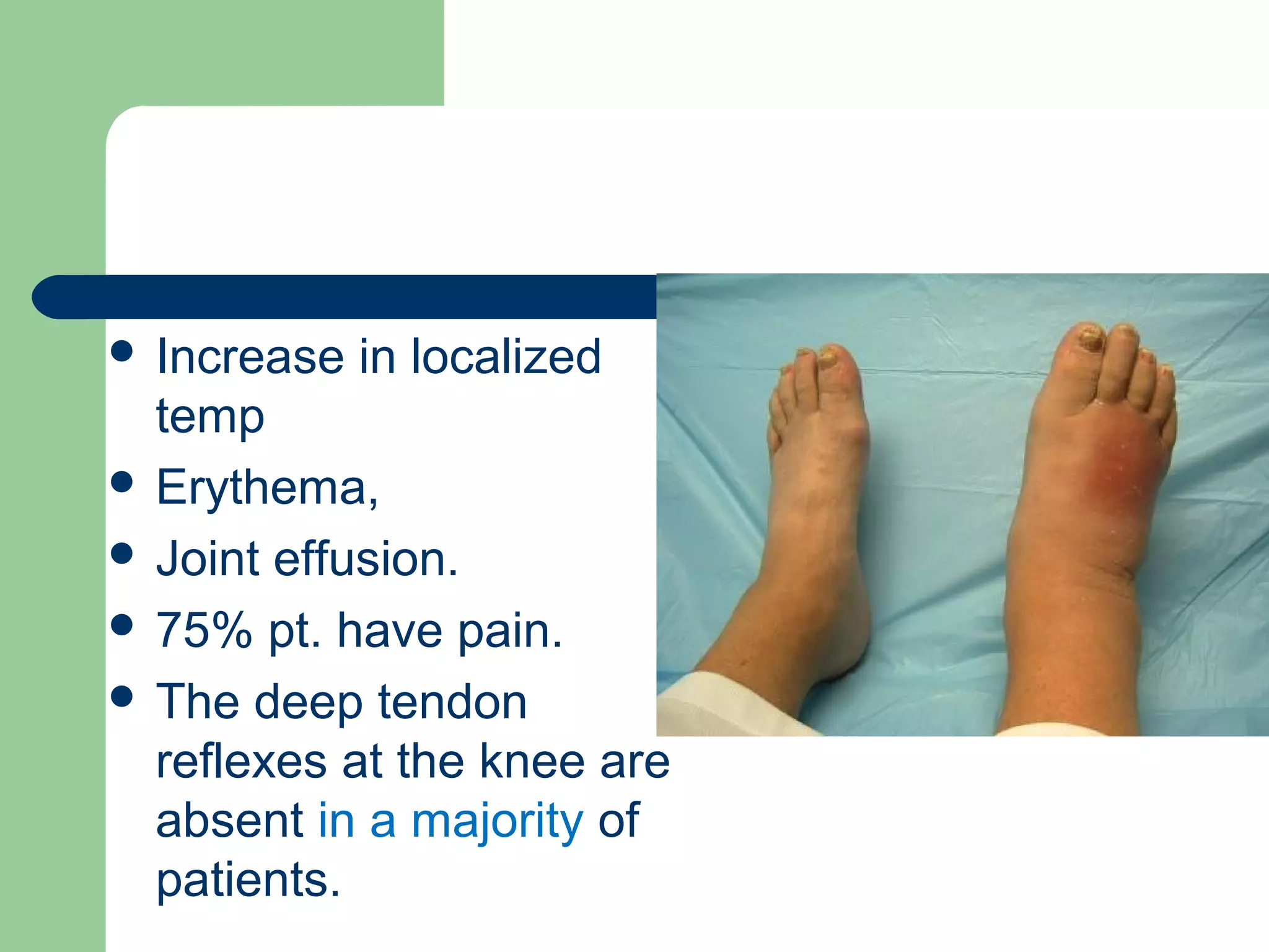  Increase in localized
temp
 Erythema,
 Joint effusion.
 75% pt. have pain.
 The deep tendon
reflexes at the knee are
absent in a majority of
patients.
 