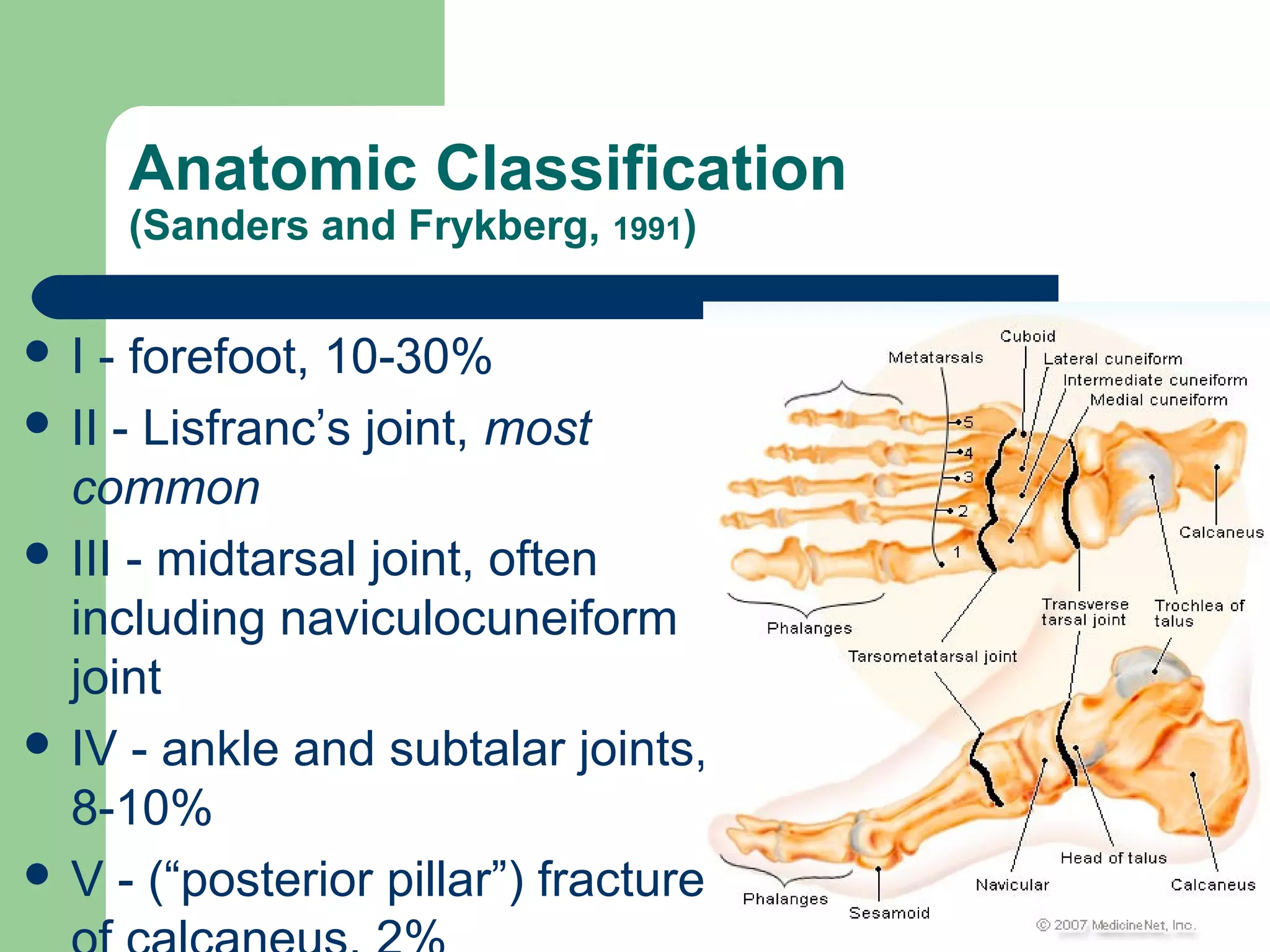 Anatomic Classification
(Sanders and Frykberg, 1991)
 I - forefoot, 10-30%
 II - Lisfranc’s joint, most
common
 III - midtarsal joint, often
including naviculocuneiform
joint
 IV - ankle and subtalar joints,
8-10%
 V - (“posterior pillar”) fractures
 