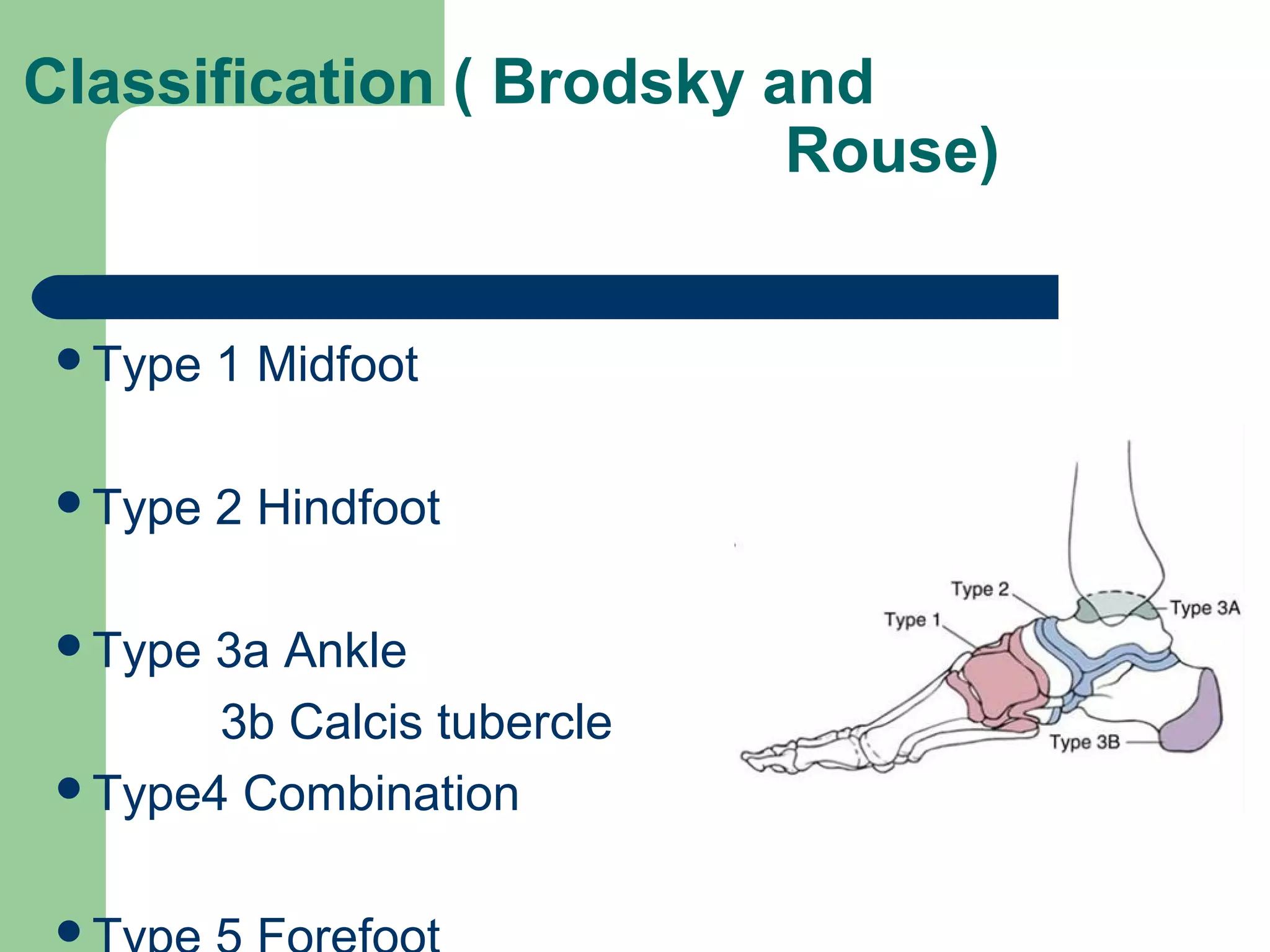 Classification ( Brodsky and
Rouse)
Type 1 Midfoot
Type 2 Hindfoot
Type 3a Ankle
3b Calcis tubercle
Type4 Combination

 
