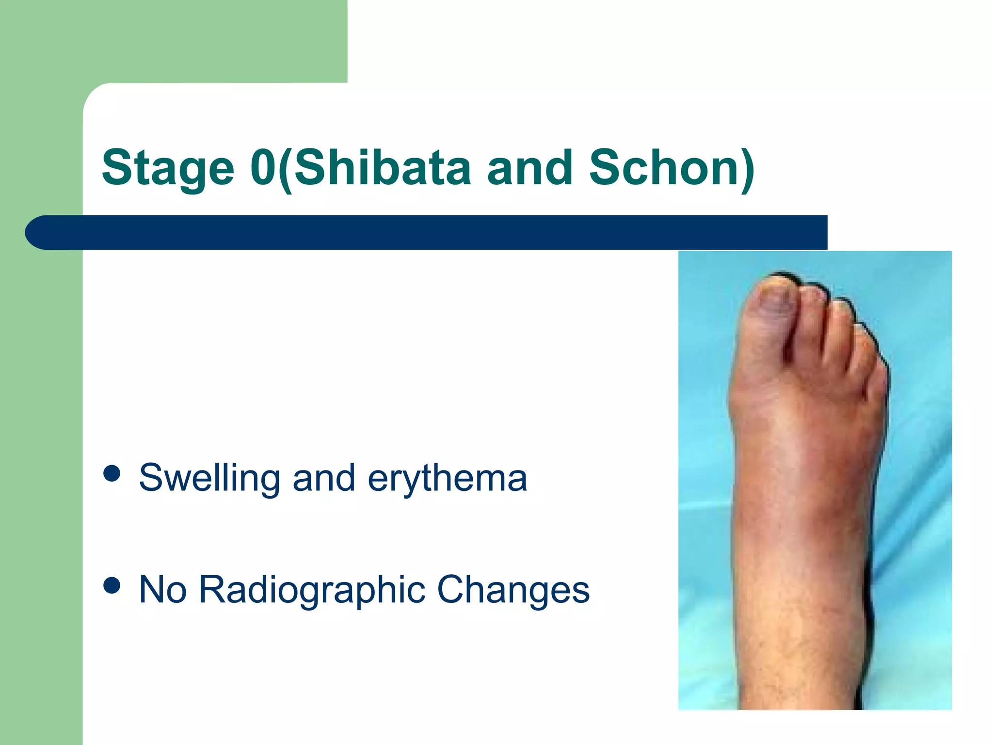 Stage 0(Shibata and Schon)
 Swelling and erythema
 No Radiographic Changes
 