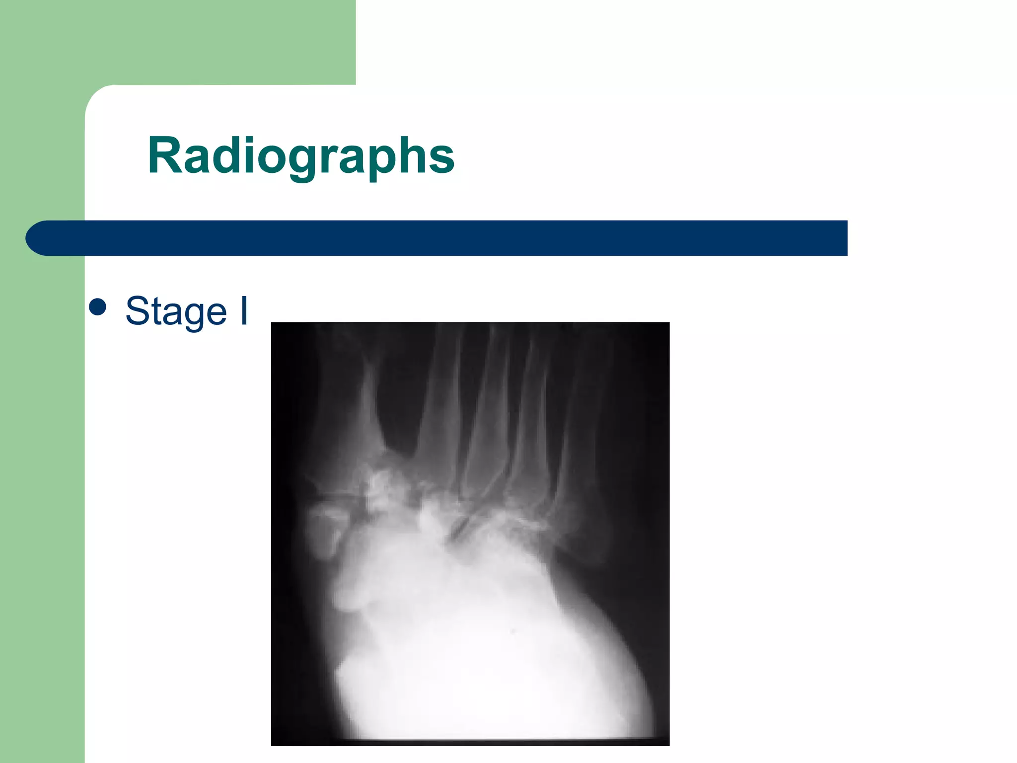 Radiographs
 Stage I
 