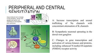 PERIPHERAL AND CENTRAL
SENSITIZATION
A: Increase transcription and axonal
trafficking of Na channels with
concomitant attenuation of K channels
B: Sympathetic neuronal sprouting in the
dorsal root ganglion
C: Changes in gene transcription and
activation of various kinases and proteins,
including enhanced N-methyl-D-aspartate
(NMDA) receptor activity
 