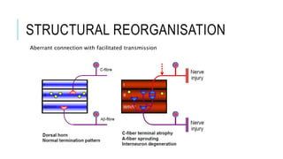 STRUCTURAL REORGANISATION
Aberrant connection with facilitated transmission
 