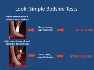Neuropathic pain diagnosis & management | PPTX
