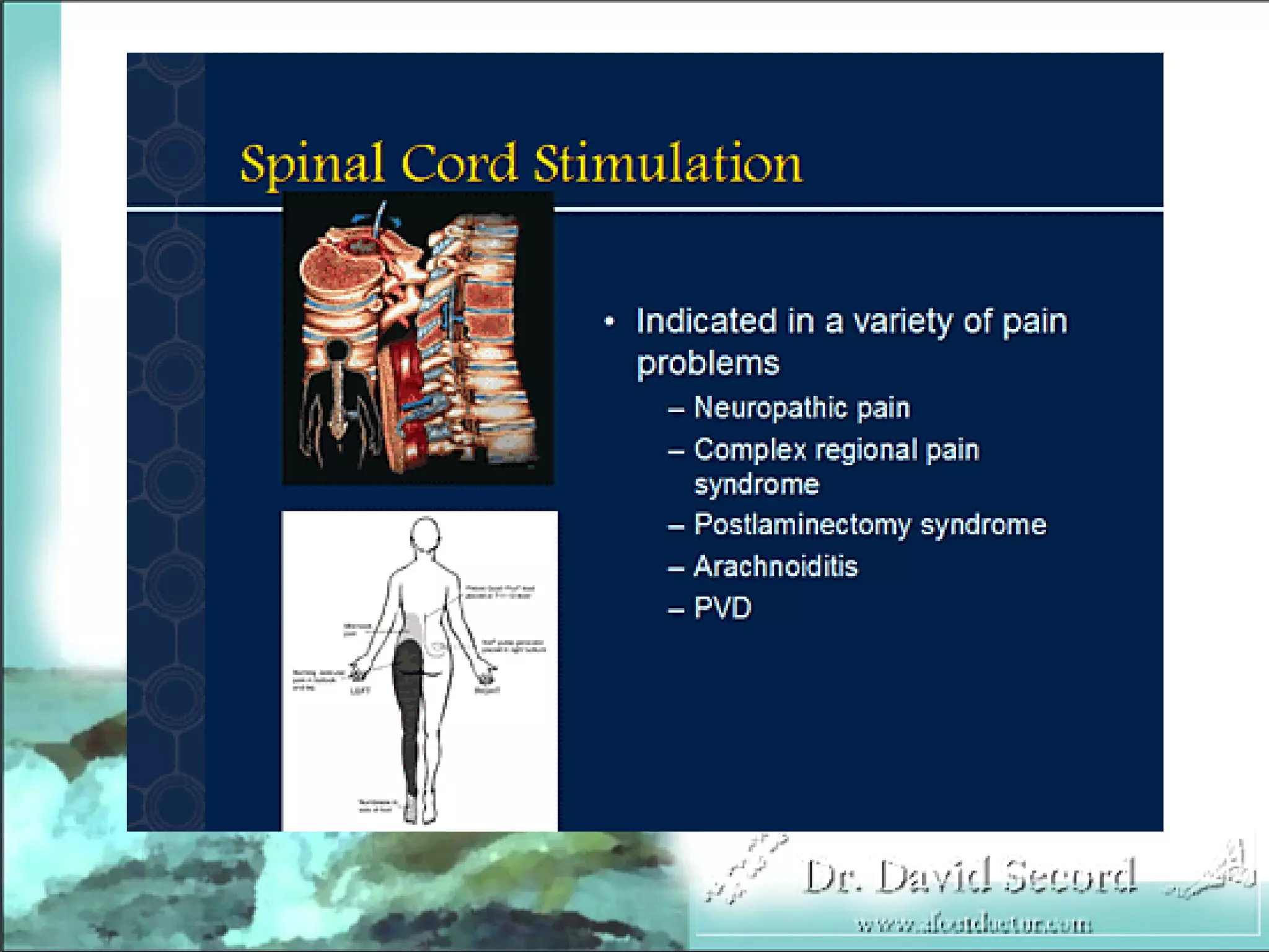 Neuropathic Pain Lecture