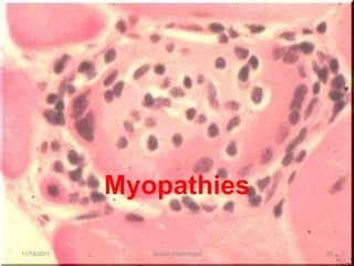 Myopathies

11/19/2011      Jipmer physiologist   50
 