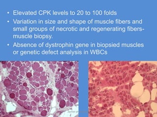 • Elevated CPK levels to 20 to 100 folds
• Variation in size and shape of muscle fibers and
  small groups of necrotic and regenerating fibers-
  muscle biopsy.
• Absence of dystrophin gene in biopsied muscles
  or genetic defect analysis in WBCs




11/19/2011            Jipmer physiologist             63
 