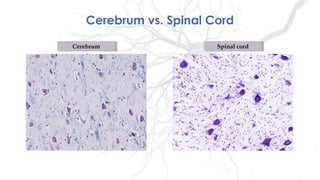 CerebrumCerebrum Spinal cordSpinal cord
Cerebrum vs. Spinal Cord
 